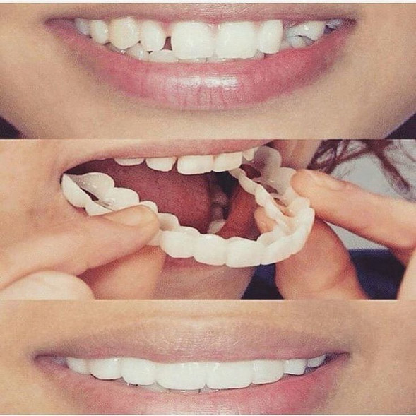 Snap on Smile в Москве