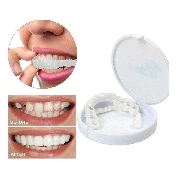 Snap on Smile в Москве